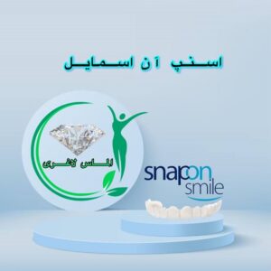 اسنپ آن اسمایل (لمینیت متحرک) snap on smile